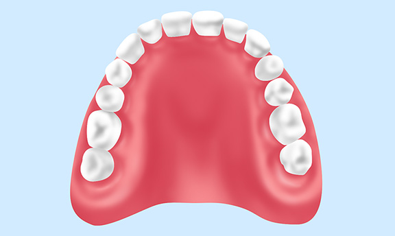 プラスチック義歯(保険診療)